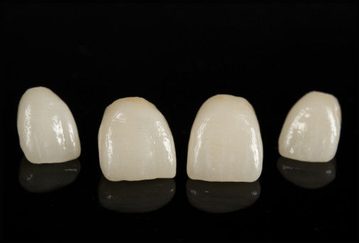 Porcelana CAD/CAM fusionada con puente de zirconio para restaurar su aspecto natural