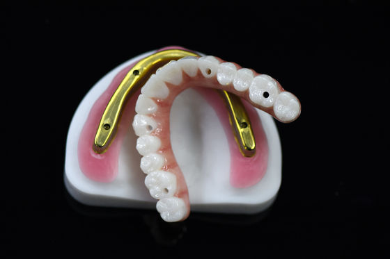 Puente de zirconia dental personalizable sobre barra de implantes fresada Alta precisión