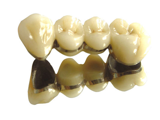comprar Color de los dientes Cobalto Coroa de cromo PFM Dental de alta nobleza PFM online manufacture