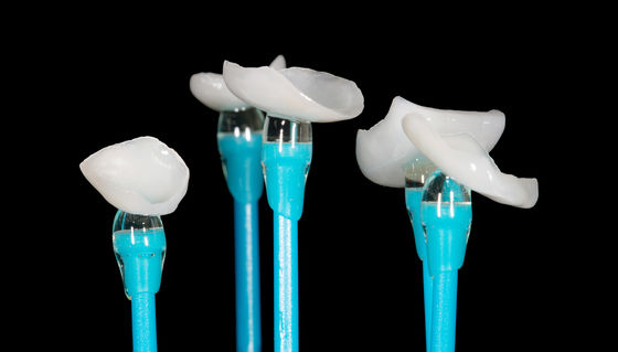 comprar EMAX Prensado Onlay Veneer Alta precisión Veneer dental Excelente ajuste online manufacture