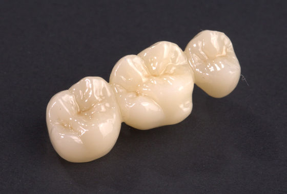 comprar Puente de zirconio de contorno completo de ajuste preciso Puente de corona de zirconio natural Alta resistencia online manufacture