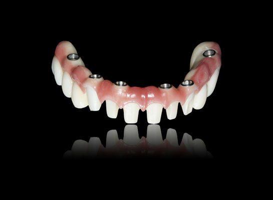 comprar Todos en X Implante puente de zirconia puente de corona apariencia natural online manufacture