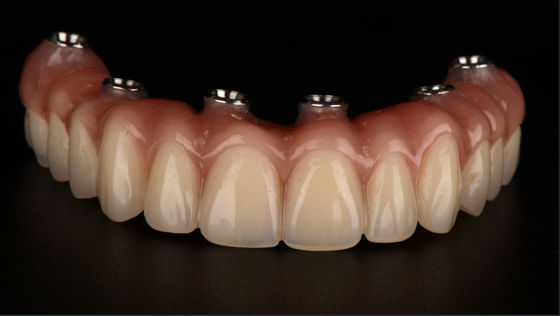 comprar Todos en X Dentaduras con apoyo de implantes Puente de titanio Dental aprobación CE FDA online manufacture