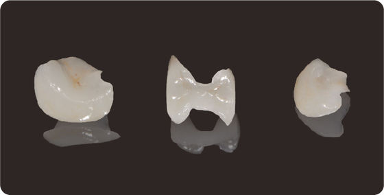 comprar Precisión de las incrustaciones dentales y las incrustaciones de litio Disilicate fresado Onlay veneer online manufacture
