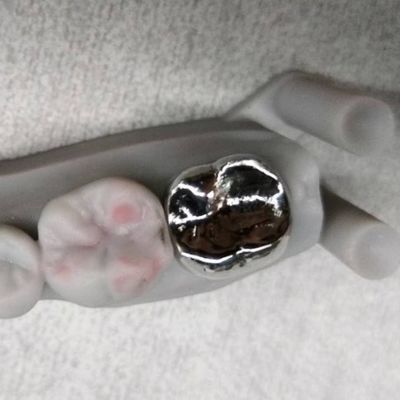 comprar Corona de metal y puente de alta precisión Corona temporal de plata online manufacture