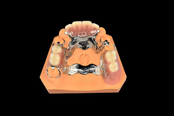 comprar Implantes dentales Dentaduras extraíbles Dentaduras parciales de metal Vitallium online manufacture