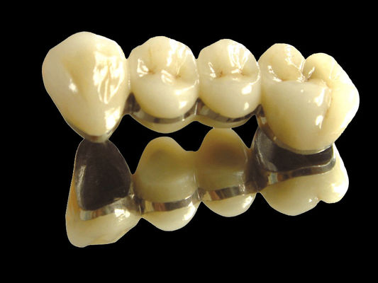 comprar Implante de puente de metal precioso puente de corona resistente al desgaste personalizado online manufacture