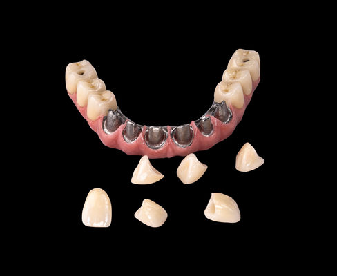 comprar Todos en X Implante de Titanio Puente Dental Sólo Marco Profesional online manufacture