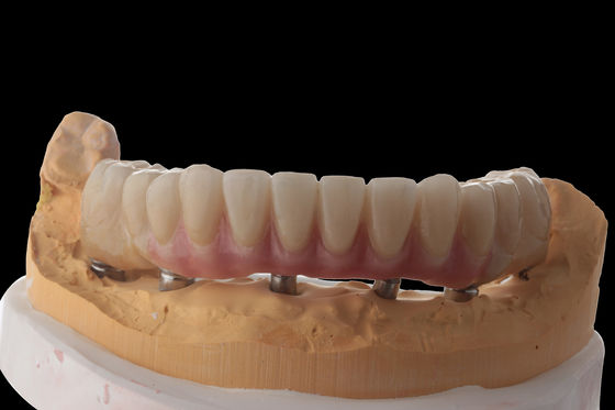 comprar Personaliza implantes dentales híbridos Dentadura híbrida con barra de titanio online manufacture