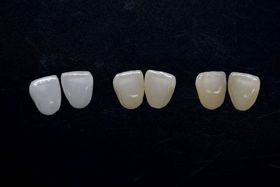 comprar Veneer de zirconia de alta estética Veneers de zirconia Emax de larga duración online manufacture