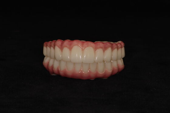 comprar Personaliza implantes dentales híbridos Dentadura híbrida con barra de titanio online manufacture