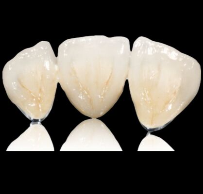 comprar Coronilla y puente de aleación preciosa online manufacture