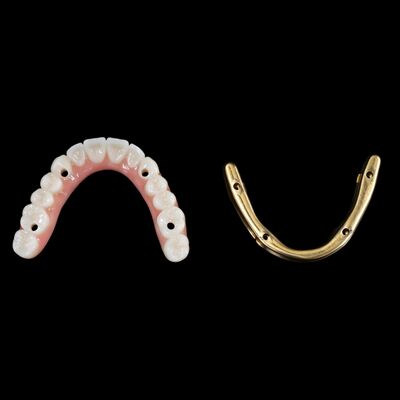 comprar Personaliza implantes dentales híbridos Dentadura híbrida con barra de titanio online manufacture