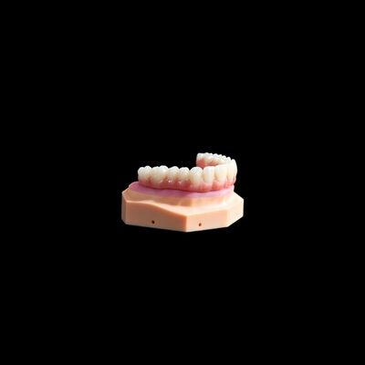 comprar Implante de corona de base de Ti corona de titanio / puente que hace frente a la composición online manufacture