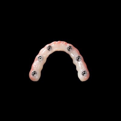 comprar Implantación de dentaduras de carga inmediata Dientes artificiales extraíbles de color rosa claro online manufacture