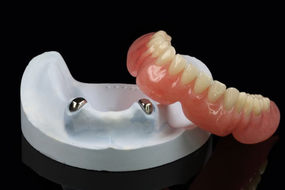 Dentaduras removibles por telescopio Apego de precisión Dentadura excesiva Arylic