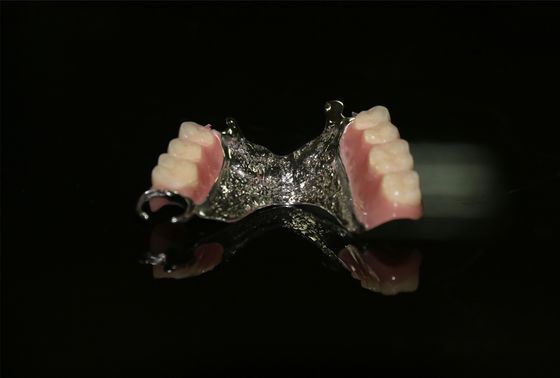 Cuadro Dental Dentes extraíbles Dentes postizos extraíbles