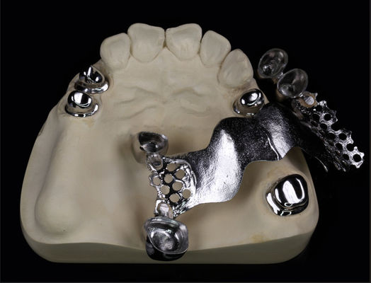 Telescopio de dientes artificiales extraíbles con composición y acabado de dentadura de marco metálico