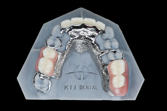 Cuadro de titanio de metal Dentadura extraíble Dentes falsos personalizados