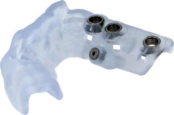 Guía de cirugía de implantes impresos Guía de cirugía dental profesional