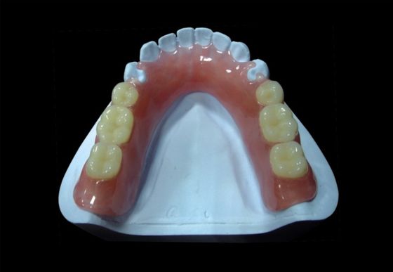 Dentadura parcial acrílica extraíble de color rosa Dentadura parcial acrílica temporal