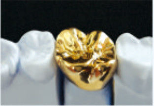 Coronilla de metal amarillo y puente de aleación preciosa Puente de corona personalizable