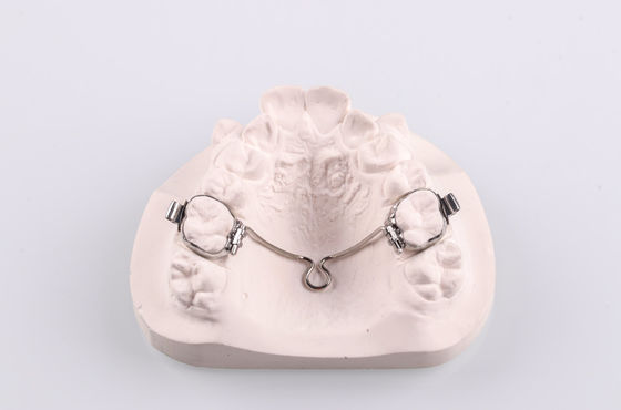 Aplicación de Nance de acero inoxidable Aplicación funcional de ortodoncia de barra palatal