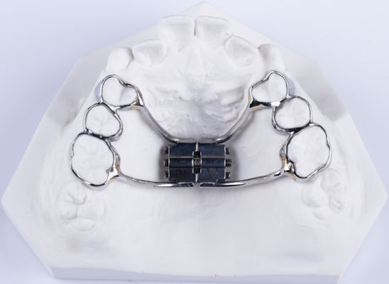 Expansión de paladar dental bidireccional fija