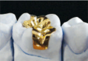 Enlaces de oro y incrustaciones de oro y incrustaciones.