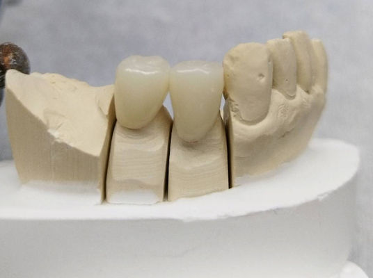 Coroa Dental Temporal PMMA Puente y Corona Temporales