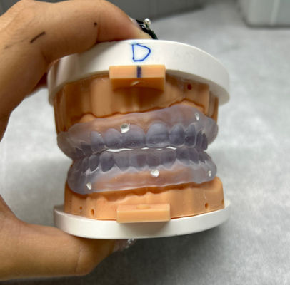 Dentes postizos impresos en 3D personalizables Prueba en la dentadura completa digital