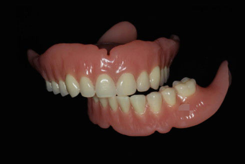 Dentes completos digitales impresos y extraíbles Dentes completos digitales rosa