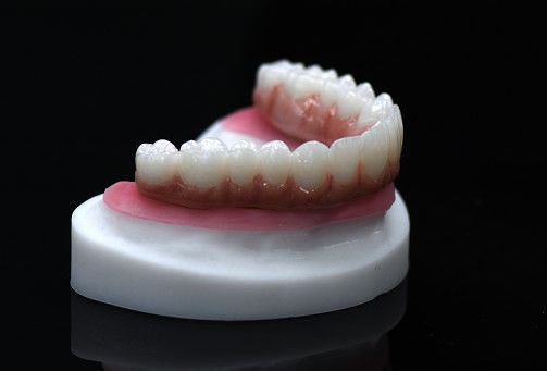 Puente híbrido de zirconio de arco completo Puente de corona de zirconio personalizado