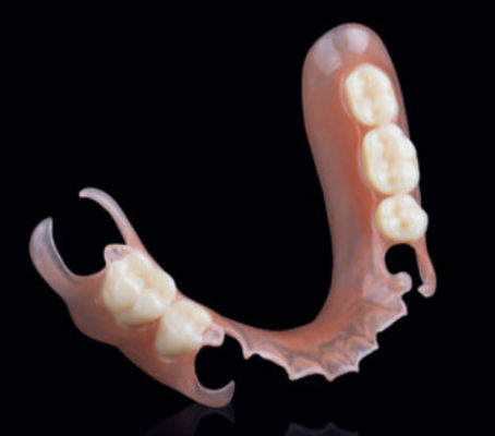 Valplast Flexible Dentes Parciales Removibles Fijación de Precisión en la Prostodoncia