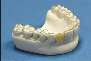Dental Dentes estables Reteniente ortodóntico Reteniente profesional claro