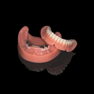 Dentaduras extraíbles de barra de titanio rosa con acabado de dentadura acrílica