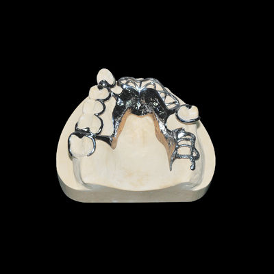 Cuadro de vitalio de alta precisión Dentadura extraíble de clase 2