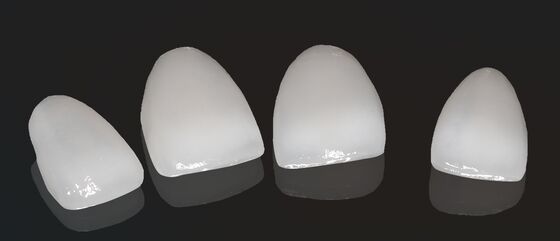 Alta estética de la corona compuesta onlay veneer tamaño personalizable